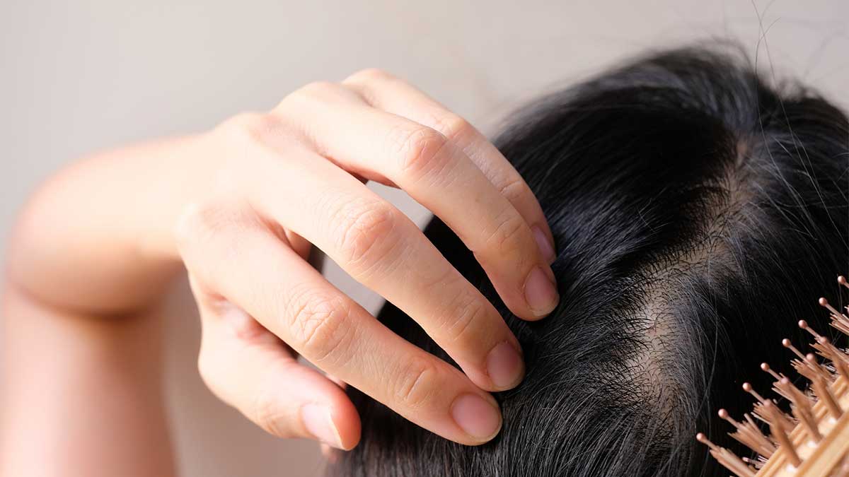 aromatherapy scalp care